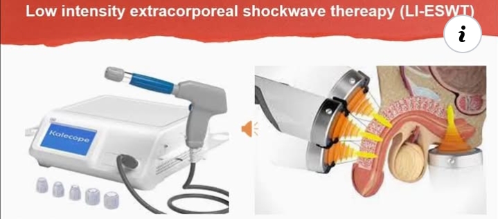 Low-Intensity Extracorporeal Shockwave Therapy for Erectile Dysfunction
